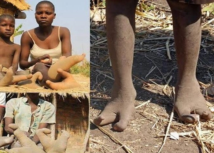 Vadoma tribe feet
